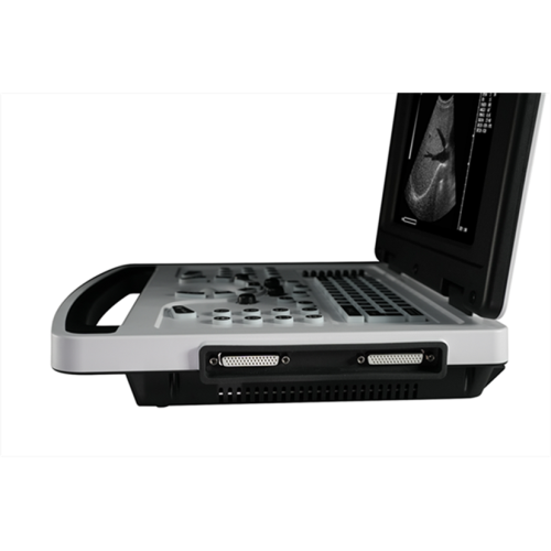 Cheap Notebook Black and White Ultrasound Scanner