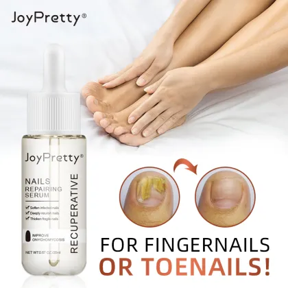 Foot Fungus Treatment: Antifungal Agents & Nail Care Solutions