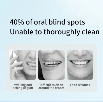 Portable Battery Operated Water Flosser for Dental Care