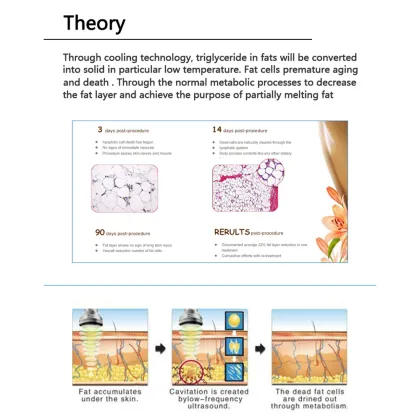 portable cryolipolysis slimming machine