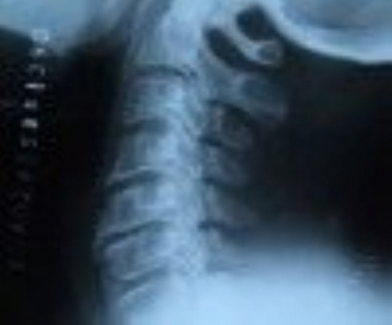 x ray film(XILONG)