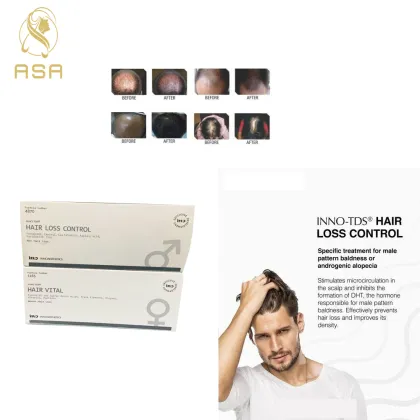 Inno-TDS Hair Loss Promote The Growth Hair Loss Control Treatment