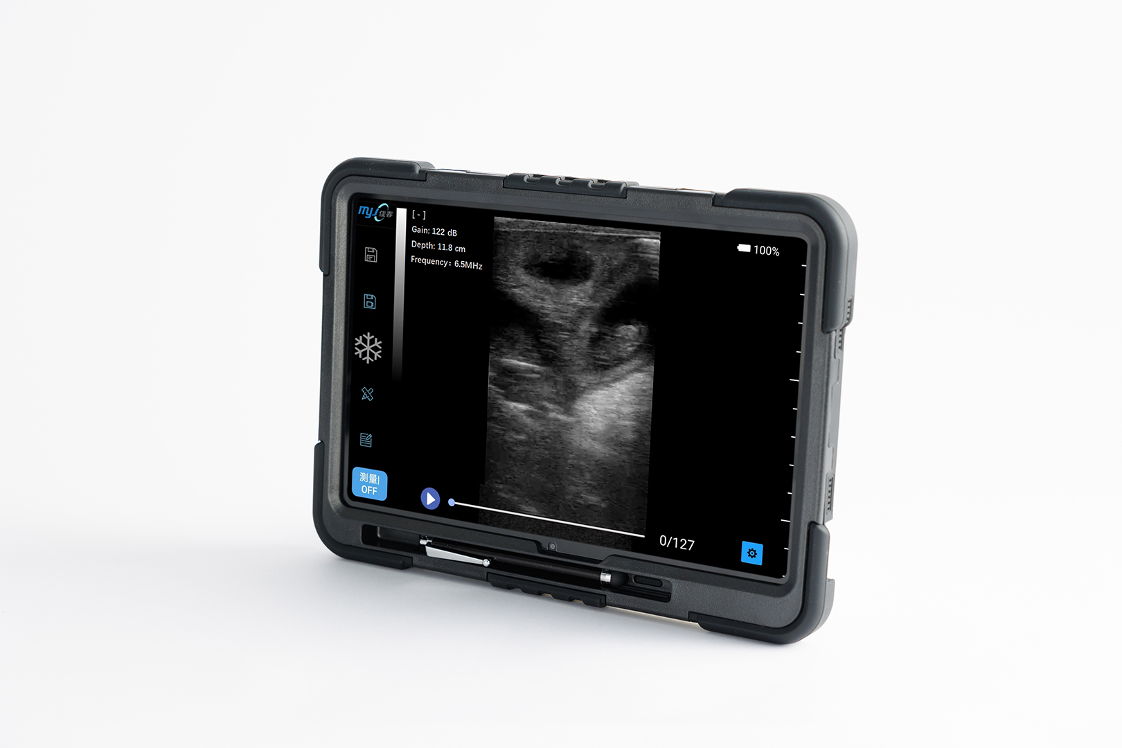 wireless ultrasound probe for iphone