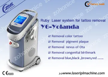 Professional Pigment Removal , Laser Tattoo Removal Machine 532nm
