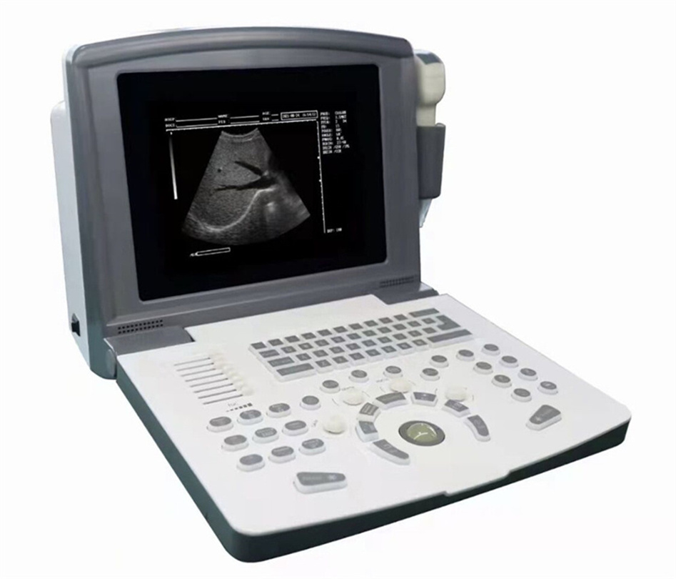 b ultrasound