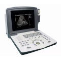 Black and White Ultrasound Scanner,Built-in Battery