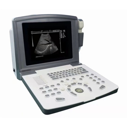 Black and White Ultrasound Scanner,Built-in Battery