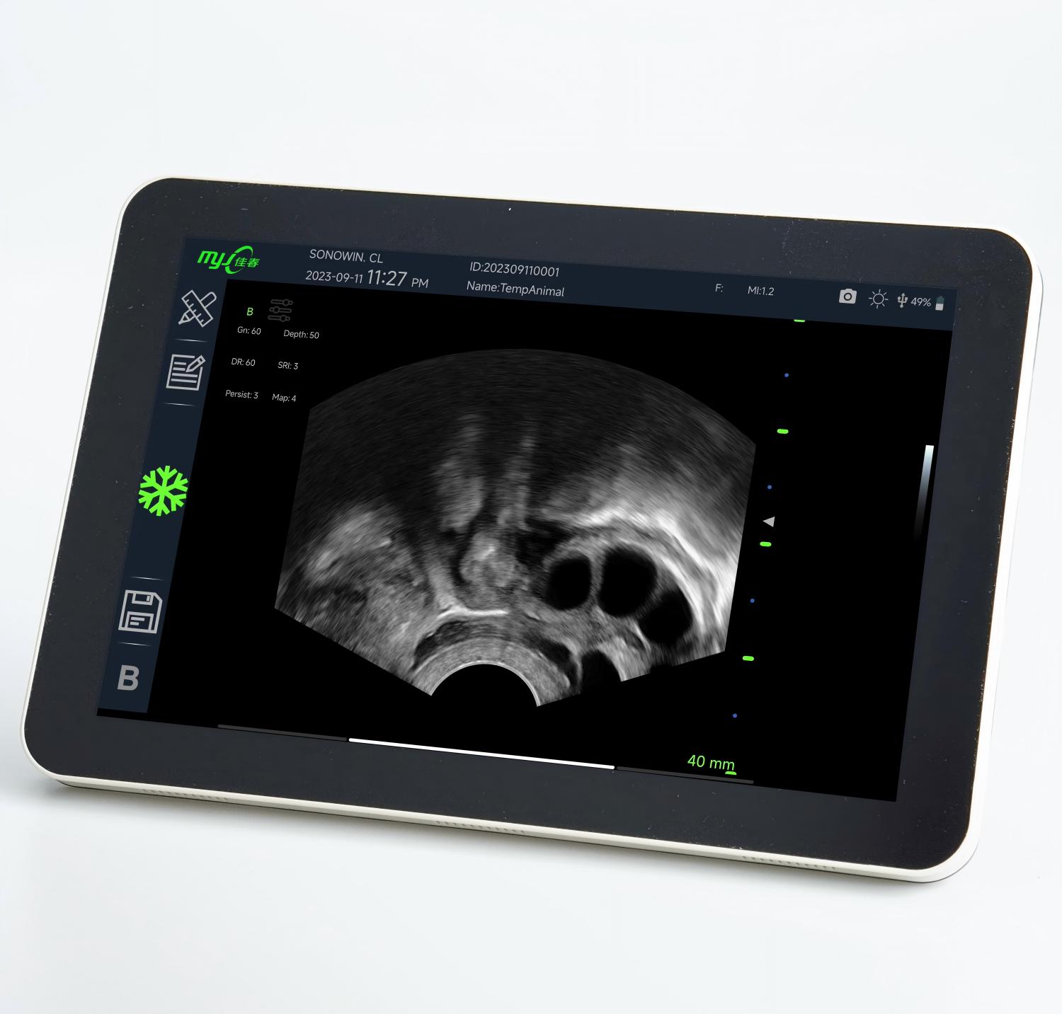cow pregnancy ultrasound