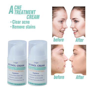 Crème pour les cicatrices d&#39;acné Pimple Dark Spot Remover