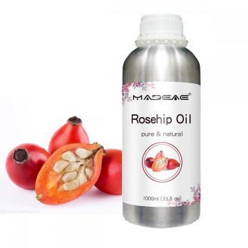 Ekstrak Tanaman Murni Minyak Esensial Rosehip Untuk Perawatan Kulit Minyak Rosehip Organik Alami