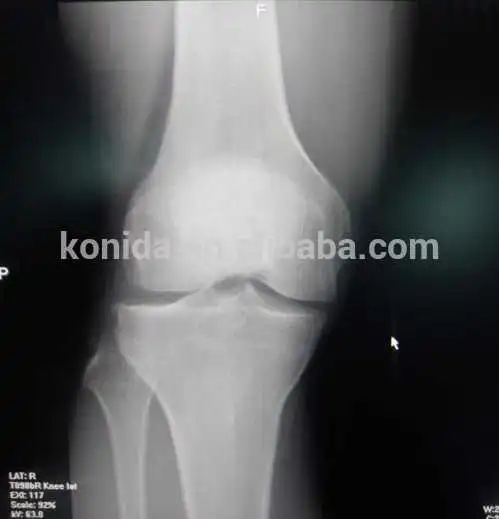 Fuji medical dry film blue xray film for Fuji Drypix 1000 2000 3000