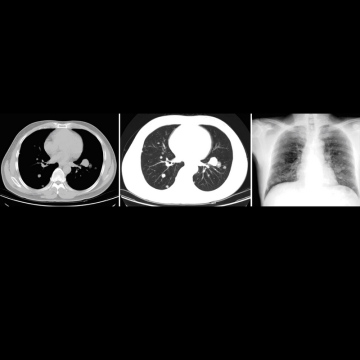 Medical image film,CT film,DR film,MRI film