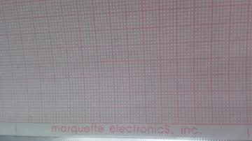 Twelve-Conduct Electrocardiograph Paper:215mmX280mm-200P(MAC5000)