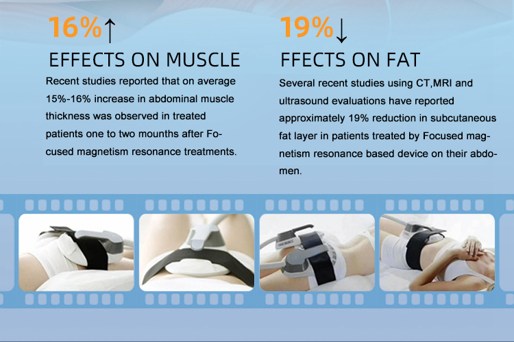 Ems Fat Burning Equipment