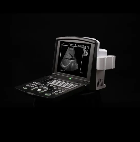 High-Resolution B Ultrasound Black and White Scanner for Medical Diagnostics