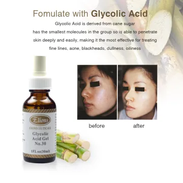 high quality glycolic acid 30% dark spot removal skin whitening peeling gel