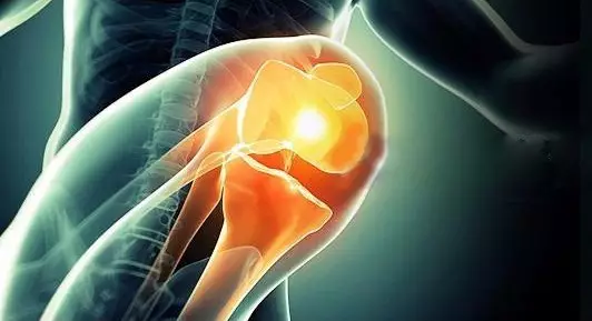 chondroitin sulfate chondroitin sulfate