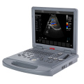 UW-L3 Laptop Color Doppler Ultrasound Scanner