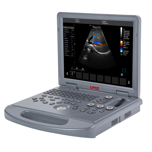 Pengimbas Ultrasound Doppler Warna Lembut UW-L3