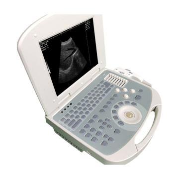 Μηχανή υπερήχων ανθρώπινου φορητού υπολογιστή για τιμή εγκυμοσύνης