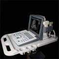 Portable Full Digital Diagnostic Ultrasound scanner