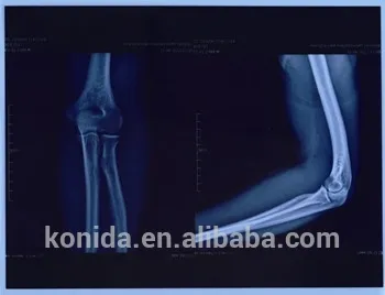 medical thermal x ray film,x ray blue film,Pet china film blue