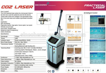 2014 Sincoheren hot sell! beauty skin fractional co2 laser Skin Renewal CO2 Laser