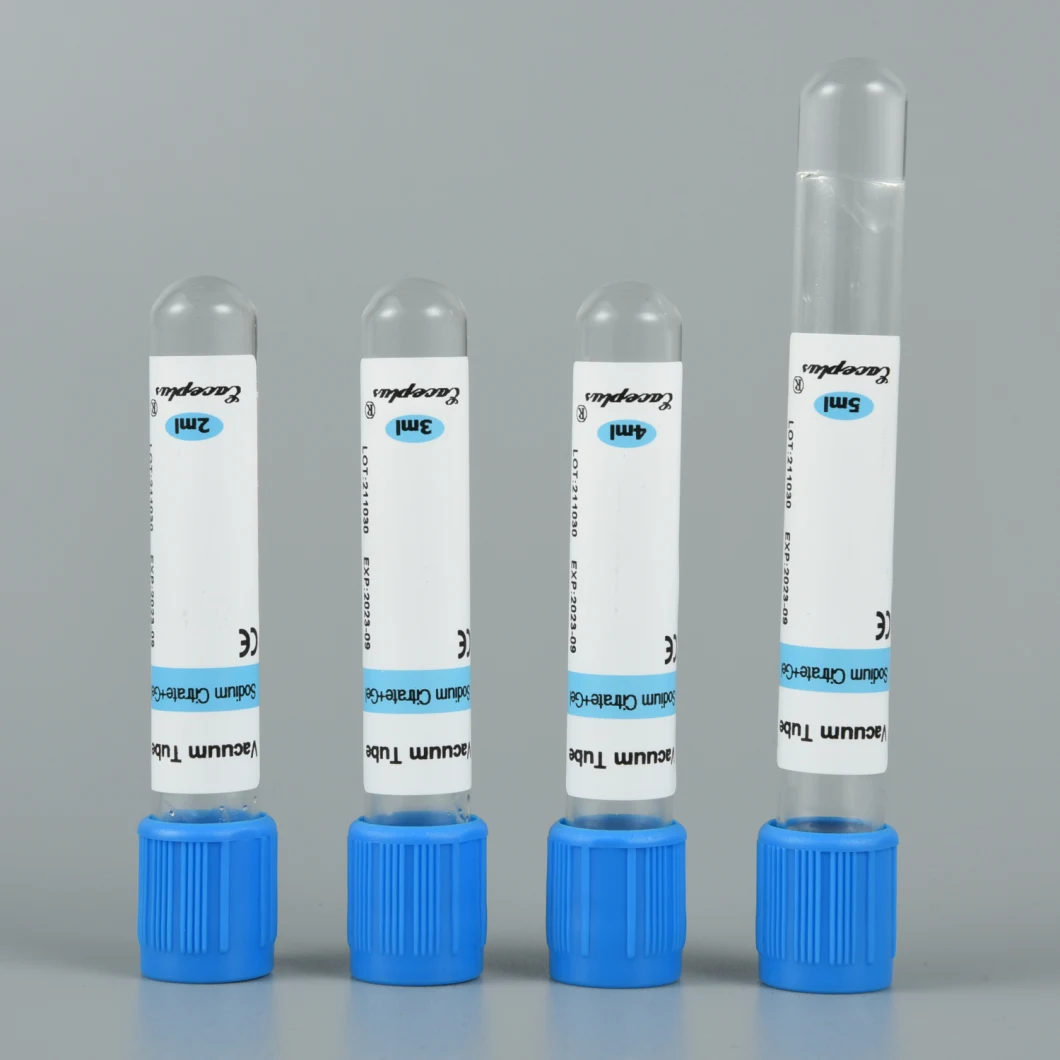 Заводская одноразовая вакуумная система сбора крови для диагностики Vacutainers Test Tube с ISO