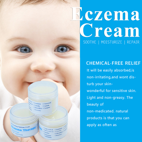 Crema di crema per baby eczema di crema per bambini eczema eczema biologici