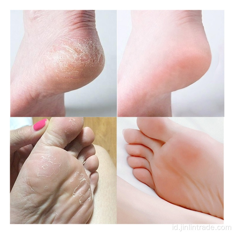 Kulit Mati alami Remover Magic Foot Masker