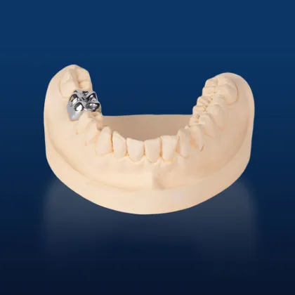 Customized Metal Dental Crown