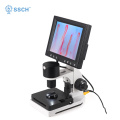 portable LED display Nailfold capillaroscope tester