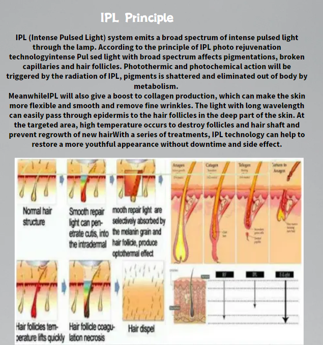 Newly Design IPL OPT E-light Intense Pulsed Light Dpl Machine Skin Rejuvenation Pigment Freckle Laser Hair Removal IPL