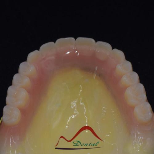 Beauty Clear Complete Denture