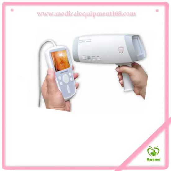 MY-F005 handheld digital electronic colposcopy