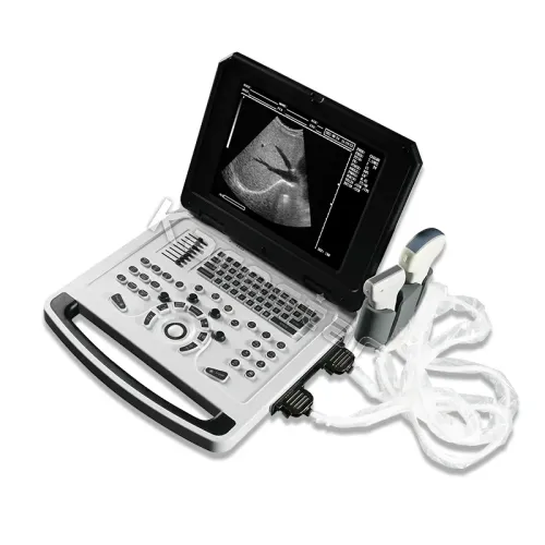 Portable B/W Ultrasound Diagnostic System
