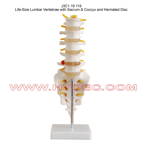 Life-Size Lumbar Vertebrae with Sacrum & Coccyx and Herniated Disc-J3C1.19.119