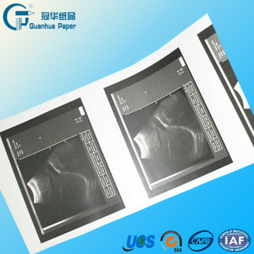 OEM Medical Video Sony Upp-110s Paper