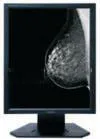 Anti-reflective Medical Grade Displays Used In Medical Imaging Equipment