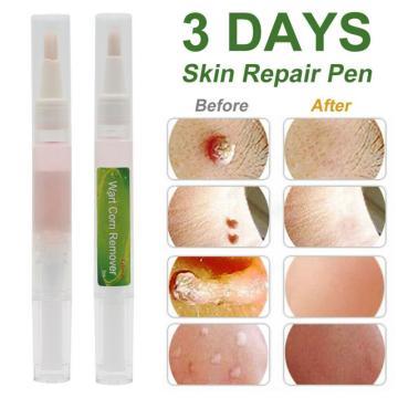 2*3ml Effective Skin Tag Remover Pen Skin Repair Pen Kill Remover Foot Corn Skin Tag Mole & Genital Liquid Wart Remover New