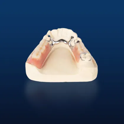 Bego Metal Partial Denture