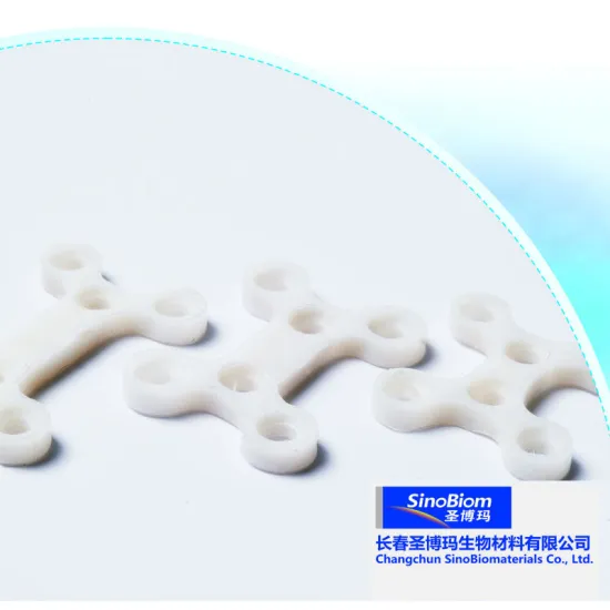 no reaction of pyrogen implants pla plates for ankle fractures