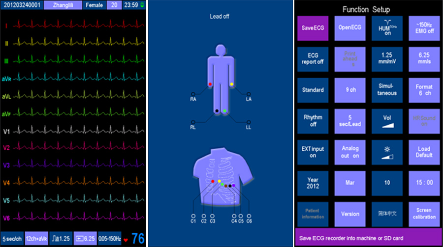 6 Channel electrocardiograph Machine