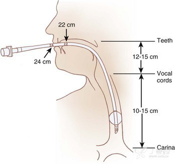pvc tracheal tube for hospital