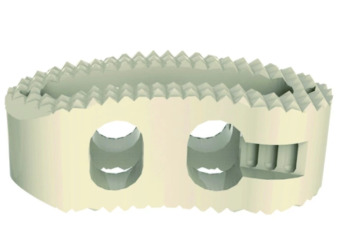 Spinal Cervical or Lumbar PEEK Fusion Cage