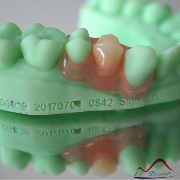 Removable Partial Elastic Denture