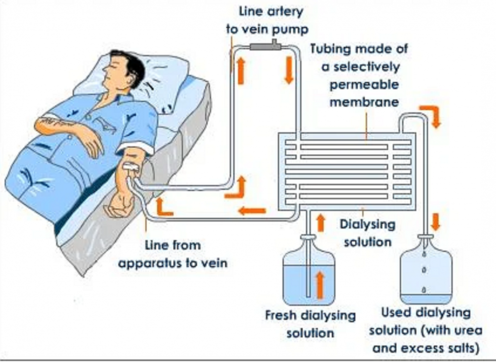 Medical Custom Hemodialysis Water Treatment Equipment