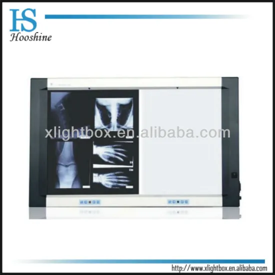 radiology X-ray view box