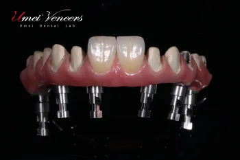 Corrosion resistant zirconia bridge