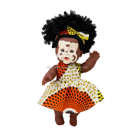 Life-Like Vitiligo Dress-Up Vinyl Doll: A Unique African-American Doll for Kids